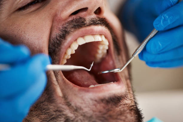 Best Root Canal Emergency Dentist  in Volo, IL